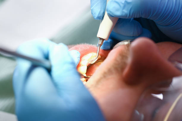 Tooth Infection Emergency Dentist in OH