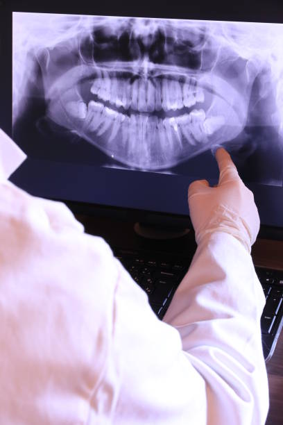 Best Root Canal Emergency Dentist  in Forest Park, OH