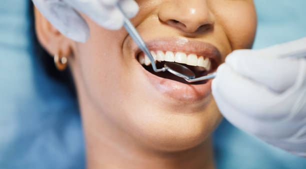 Best Dentist for Tooth Abscess  in Forest Park, OH
