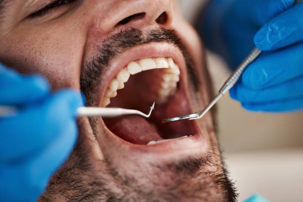 Best Emergency Dentist Near Me  in Forest Park, OH